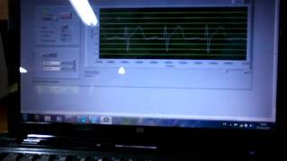 Electrocardiografo inalambrico xbee wlan labview pic18f4550 Unillanos MACRYPT [upl. by Mariandi401]