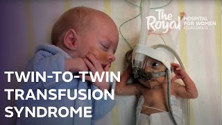 TwinToTwin Transfusion Syndrome TTTS Nicoles Story [upl. by Ennobe122]