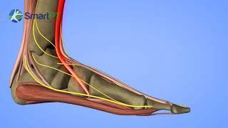 Guide to Peroneal Tendonitis [upl. by Noellyn]