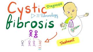 Cystic Fibrosis  Diagnosis amp Treatment  Genetics [upl. by Sabelle]