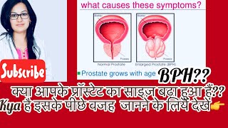 BPH Prostate Enlargement Common Causes गदूद का फूलनाप्रॉस्टेटSymptomsByDr Rukmani Choudhary [upl. by Ovid]