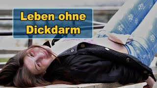 12 Jahre Leben mit Colitis Ulcerosa  Erfahrungsbericht  Normalo TV [upl. by Nueovas352]