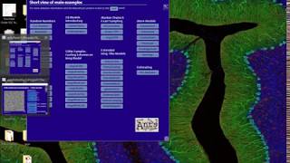 Lecture 22 MRFs on Grid  Undirected Probabilistic Graphical Models  MLCV 2017 [upl. by Astor643]