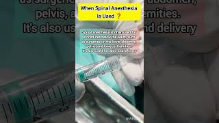 When Spinal Anesthesia is used in surgery  doctor mbbs neet medical anesthesia medicalstudent [upl. by Aiekam]