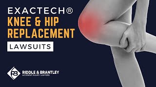 Exactech Knee amp Hip Replacement Lawsuits  June 2024 Update  Attorney Gene Riddle [upl. by Linker]