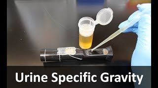 Urine Specific Gravity Refractometer [upl. by Secrest]