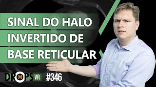 SINAL DO HALO INVERTDO DE BASE RETICULAR [upl. by Fawn254]