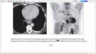 chest imaging from diagnostic imaging series [upl. by Manno221]