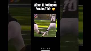 Aidan Hutchinson breaks tibia while sacking Dak Prescott nfl cowboys detroitlions injury [upl. by Eelirem]