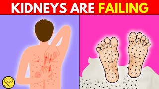 Your Kidneys Are Crying for Help 8 STRANGE Signs by Vitalhealth6 [upl. by Ennasil]