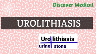 Urolithiasis  Reason Symptoms Diagnosis  Kidney stones [upl. by Meris100]