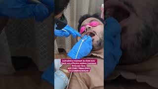 Leukoplakia treatment by diode laser in Aurangabad white patch treatment osmf treatment drgunjangar [upl. by Benenson590]