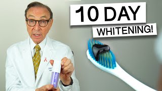 Hismile Purple Toothpaste for 10 Days  Dentist Review teethwhitening [upl. by Sabba]