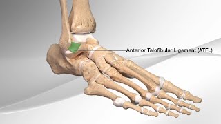 Fix TWISTED Ankle ROLLED Ankle or SPRAINED Ankle Ligaments FASTER [upl. by Dnomed]