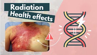 Side effects of Radiation  Deterministic vs Stochastic effects [upl. by Urbannai]