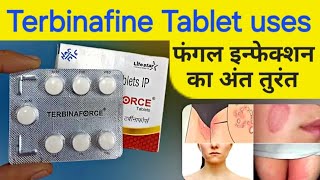 Terbinafine tablets ip 250 mg  terbinafine tablets uses in hindi  terbinaforce tablets [upl. by Suellen124]