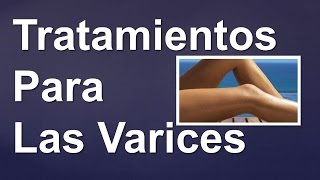 TRATAMIENTOS PARA LAS VARICES  Tratamiento de las varices naturalmente [upl. by Toni]