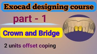 exocad designing  exocad training  offset coping designing in exocad [upl. by Dov92]