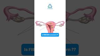 NonSurgical Fibroid Treatment Safe FDAApproved Solution  C3 Medicares Holistic Approach✨ [upl. by Aihsein681]