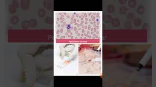 Peripheral blood film examination [upl. by Allistir726]