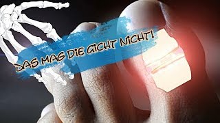 Das mag die Gicht nicht [upl. by Wendelin]