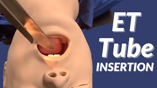 How to Insert an Endotracheal Tube ET Tube [upl. by Essirahs]