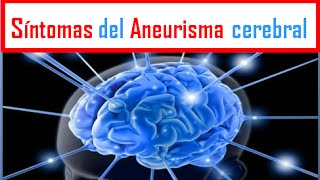 ANEURISMA Síntomas del Aneurisma cerebral [upl. by Annyahs496]