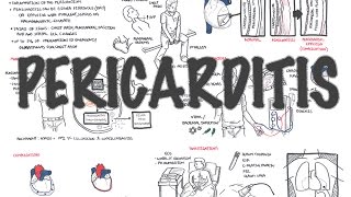 Pericarditis  Overview signs and symptoms pathophysiology diagnosis treatment [upl. by Halfon]