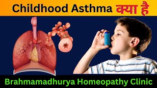 Childhood Asthma Homeopathic Approaches for Relief and Management [upl. by Macknair]