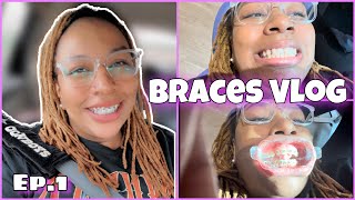 COME WITH ME TO GET BRACES ON FOR THE FIRST TIME •My Adult Braces Journey • Ep1 Vlog 2023 [upl. by Awahsoj]