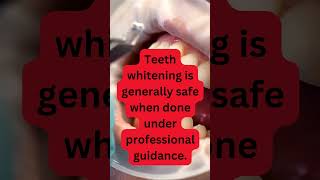 The Truth About Teeth Whitening Safety Revealed [upl. by Antoinetta]