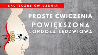 Powiększona Lordoza Lędźwiowa  Ćwiczenia  OTYŁOŚĆ BRZUSZNA [upl. by Haslett846]