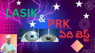 LASIK VS PRK WHAT TO CHOOSE  LASIK VS PRK ఏది బెస్ట్   TELUGU [upl. by Auqinihs976]