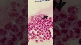 Gram Stain Smear  Neisseria gonorrhoeae  Microbiology science biology microbiology medical [upl. by Riorsson]