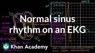 Normal sinus rhythm on an EKG  Circulatory System and Disease  NCLEXRN  Khan Academy [upl. by Yelssew]