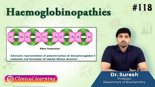 118 Haemoglobinopathies  Medical Biochemistry  USMLE FMGE and NEET PG [upl. by Moorish]