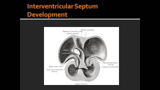 Interventricular Septum Development [upl. by Notffilc]