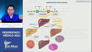 Gastroenterología  13 Hepatopatias por Alcohol [upl. by Upshaw700]