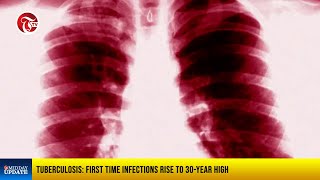 middayupdate  Tuberculosis First time infections rise to 30year high [upl. by Inail]