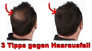 3 Tipps gegen Haarausfall [upl. by Eissed44]