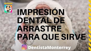 ⏭️ lmpresión DENTAL de ARRASTRE 👅materialesdentales dental [upl. by Ecyac526]