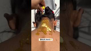 ✅️ Neck Cleaning Tips  Dark Neck Home RemediesTanning Removal Tips 😱beautyskincareshortsviral [upl. by Naginarb]