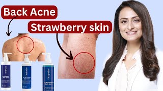 My Verdict on the Be Bodywise Bodycare Range for Back Acne amp Strawberry Legs [upl. by Botsford439]