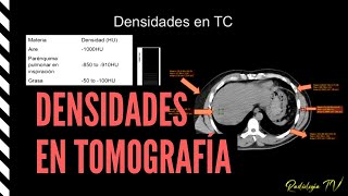 Densidades en tomografía [upl. by Akihsal46]