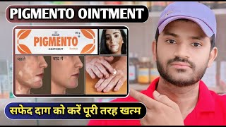 Pigmento ointment use dose benefits and Side effects full review in hindi [upl. by Jake]