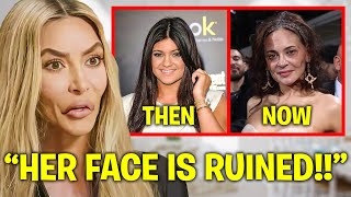 Kim Kardashian EXPOSES Kylie Jenner’s BOTCHED Plastic Surgery [upl. by Aidni470]