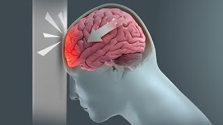 How Traumatic Brain Injury TBI Affects Brain Cells  New Research Could Lead to New Treatments [upl. by Ailgna555]