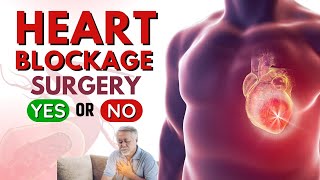 Heart blockage होने पर क्या करें  Heart Stent Surgery Side Effects  Shuddhi Ayurveda [upl. by Lledniw308]