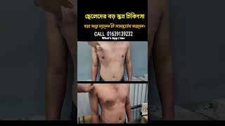 Gynecomastia Surgery Cost [upl. by Dnomad]