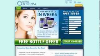 Rosacea Skin Care  Free Bottle Of Revital Acnezine For Trial Acne free offers [upl. by Guillema]